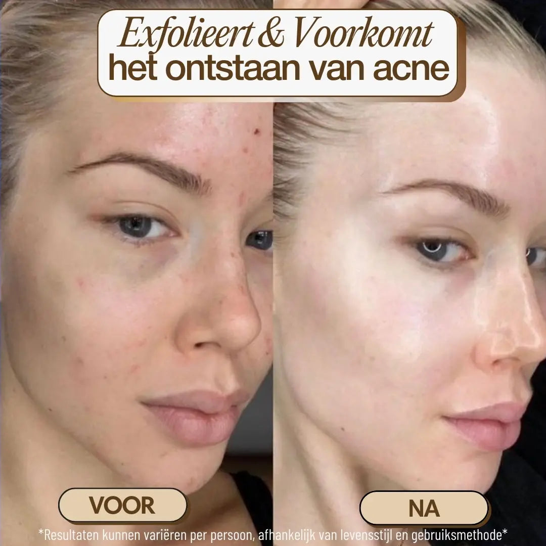 nl-photo-facial brush