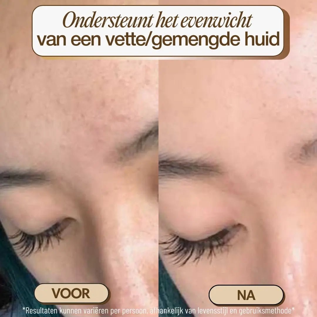 nl-photo-facial brush