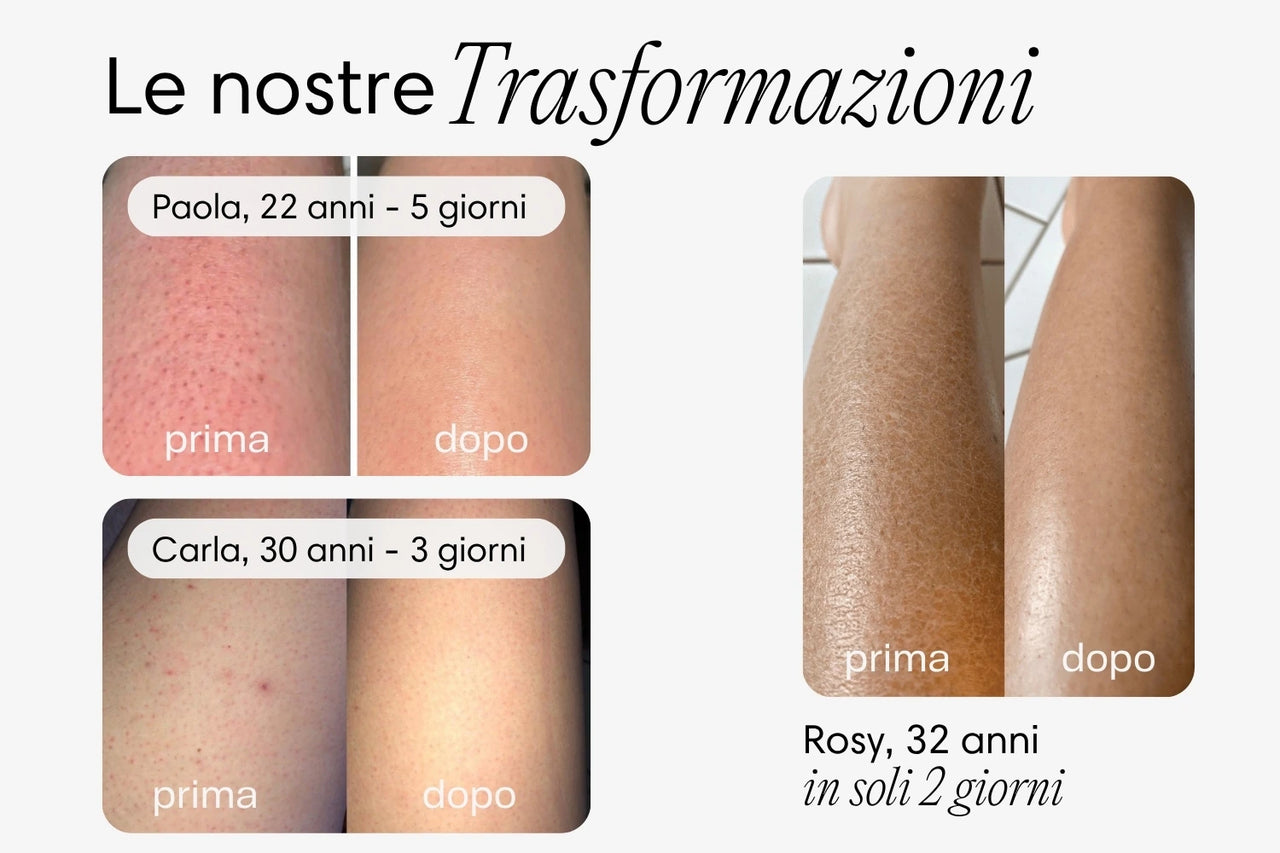 iBrushy Droogborstel