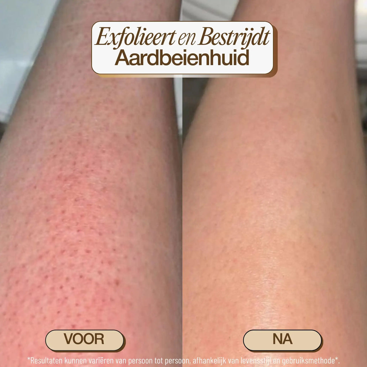 nl-photo-body-brush